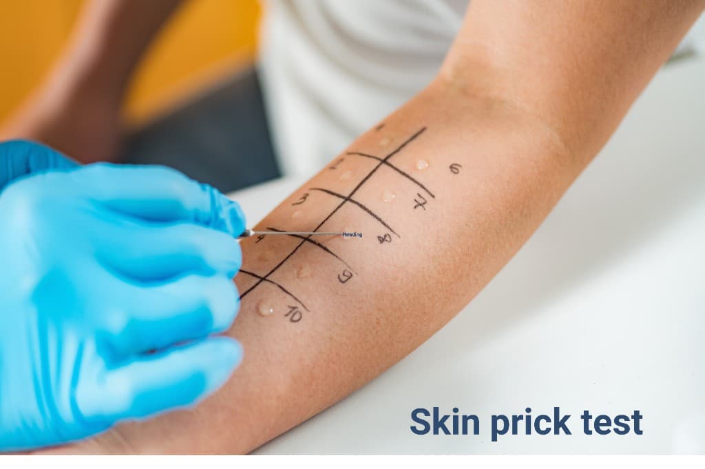 บริการทดสอบภูมิแพ้ทางผิวหนัง (Skin Prick Test) ที่ราชวิถีคลินิก หู คอ จมูก เชียงใหม่